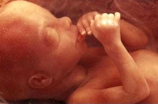 Unborn baby corrected