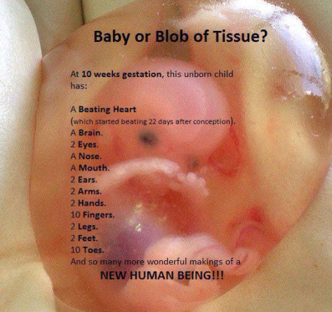 baby-22-days-4thoseilove