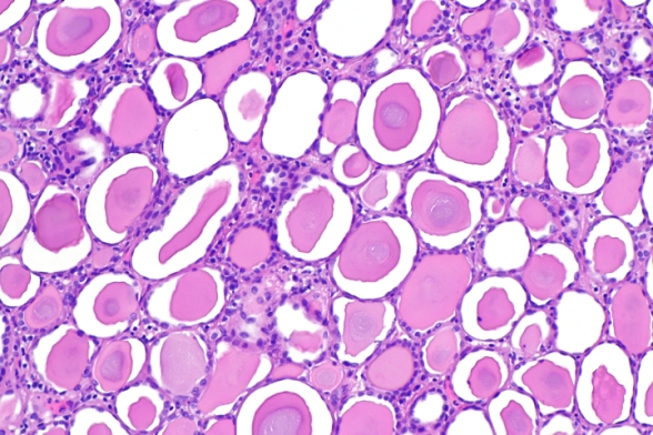kidneypic-1