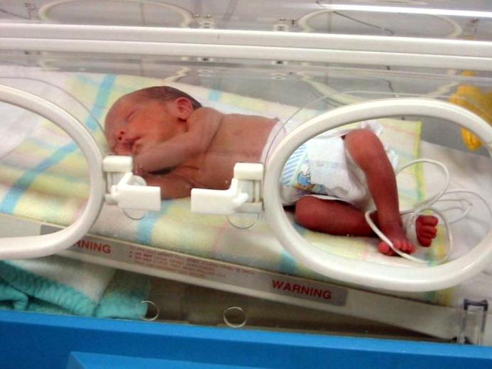 Baby born way premature sm print